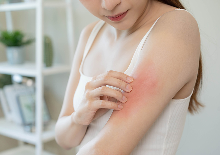 内科で行うアレルギー診療